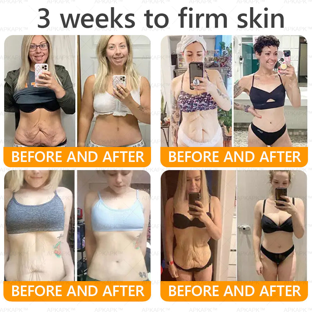 Made and Shipped from AU ✨ LBMLBM® Bee venom Comprehensive Cream 🔥 LAST DAY 80% OFF 💎💎