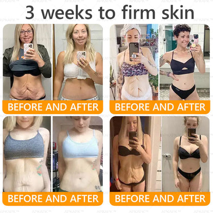 Made and Shipped from AU ✨ LBMLBM® Bee venom Comprehensive Cream 🔥 LAST DAY 80% OFF 💎💎