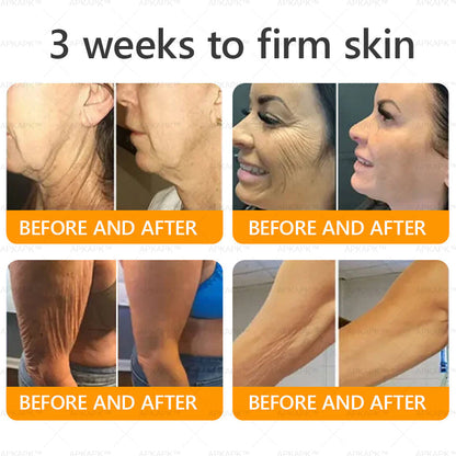 Made and Shipped from AU ✨ LBMLBM® Bee venom Comprehensive Cream 🔥 LAST DAY 80% OFF 💎💎