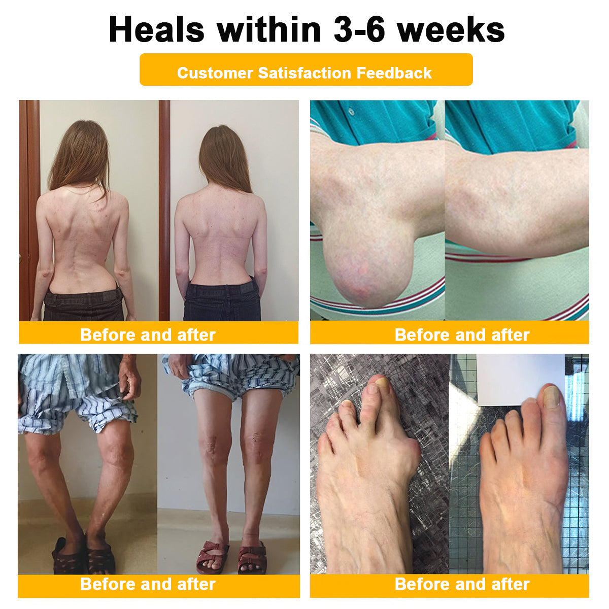 🎁Flash Sale - ODALIT™ Botulinum Toxin & Bee Venom Pain-Relief Bone Healing Cream 🐝💎