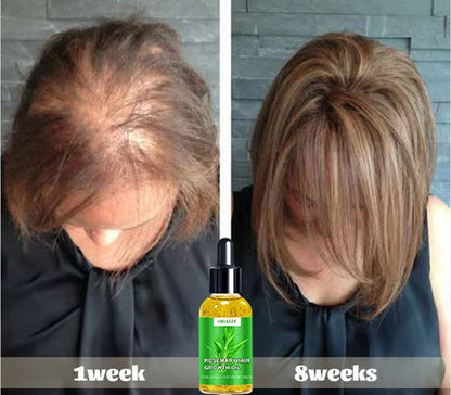 🌱ODALIT™ Hair Growth Serum