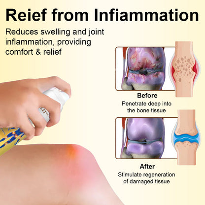 ODALIT™ Magnesium Oil & Bee Venom Joint Healing Spray🐝