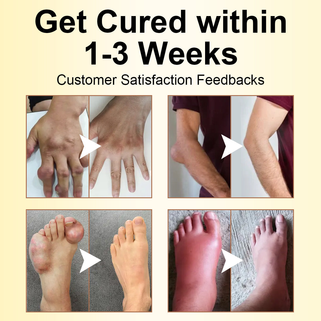 ODALIT™ Magnesium Oil & Bee Venom Joint Healing Spray🐝