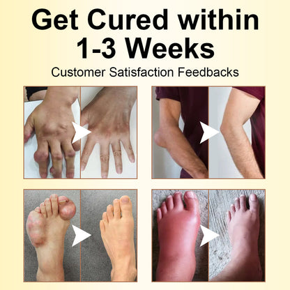 ODALIT™ Magnesium Oil & Bee Venom Joint Healing Spray🐝