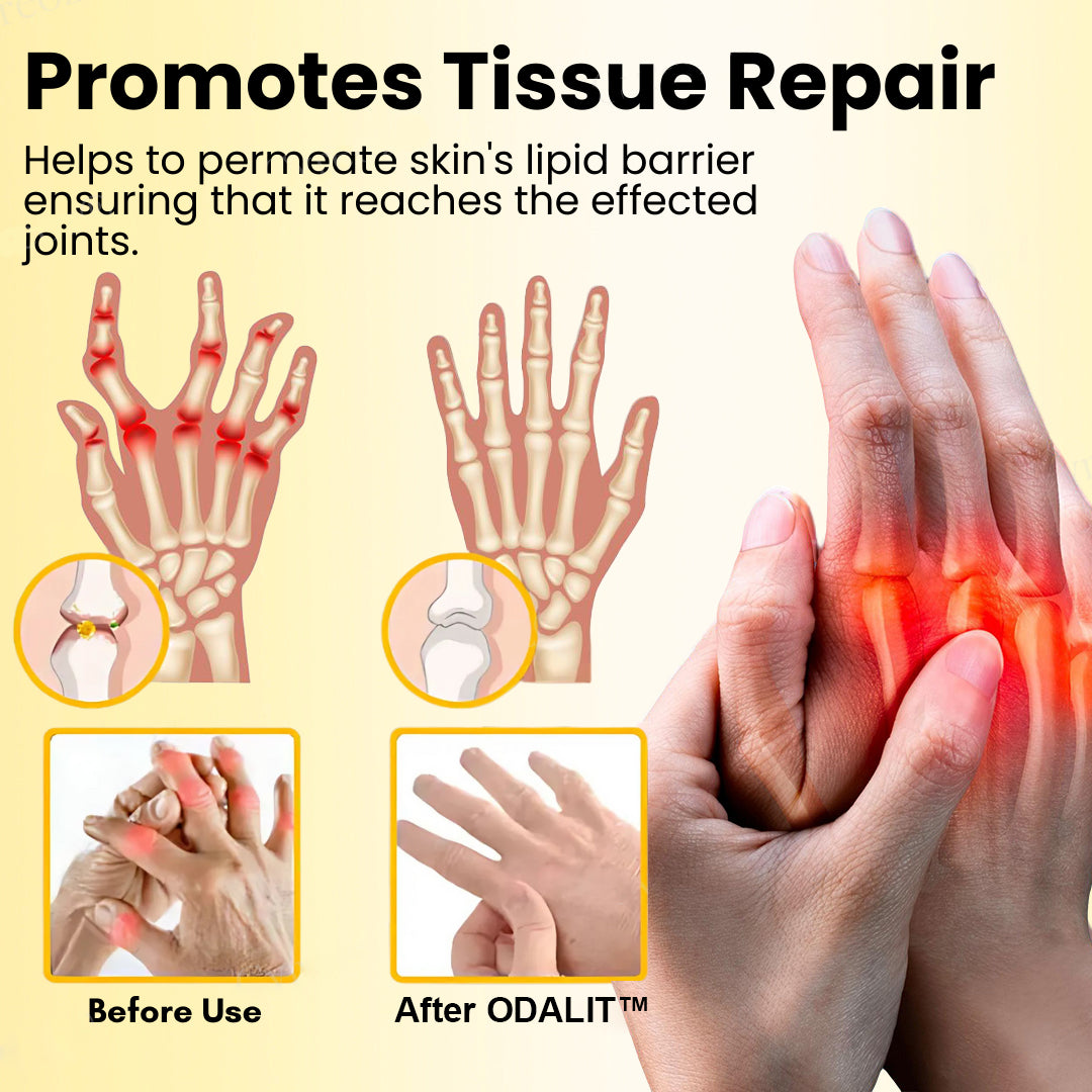 ODALIT™ Magnesium Oil & Bee Venom Joint Healing Spray🐝