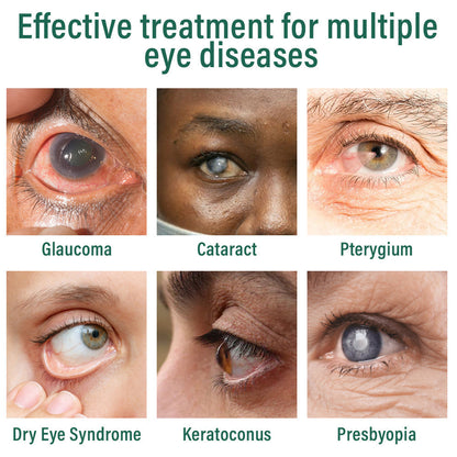 👩‍⚕️ODALIT™ Nano Eye Drops Serum ✅FDA Approved(Suitable for presbyopia, dry eye syndrome, glaucoma, and cataracts) ☘️☘️