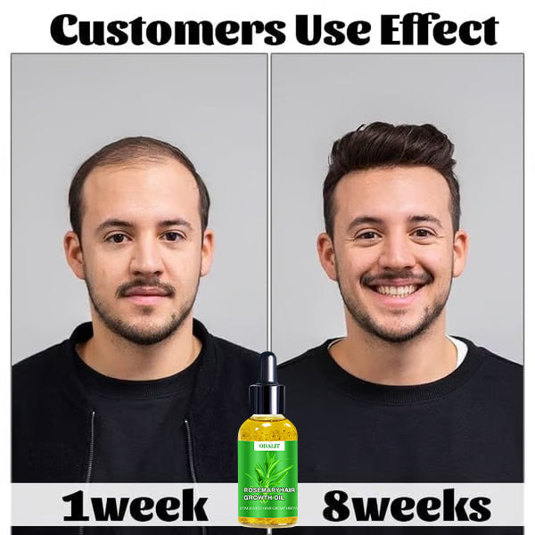 🌱ODALIT™ Hair Growth Serum