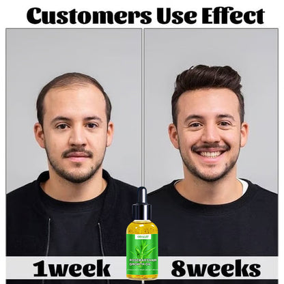 🌱ODALIT™ Hair Growth Serum