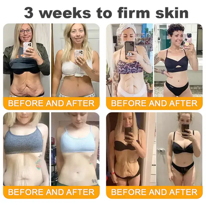 ⏰ LAST DAY 80% OFF ✨ ODEIUN™ Bee Venom Skin Restoration Cream