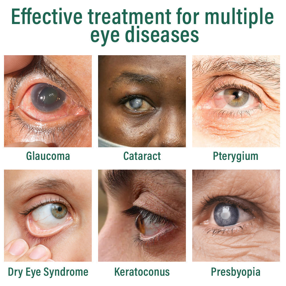 👩‍⚕️LBMLBM® Nano Eye Drops Serum ✅FDA Approved(Suitable for presbyopia, dry eye syndrome, glaucoma, and cataracts) 🌻