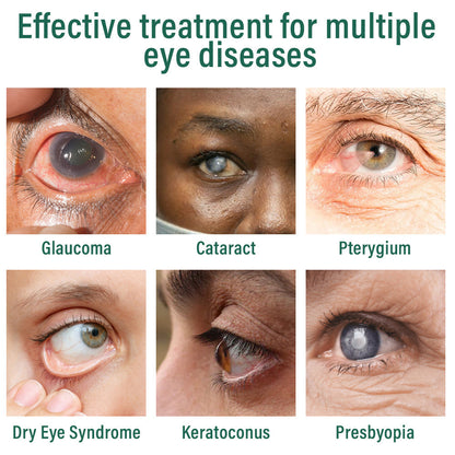 👩‍⚕️LBMLBM® Nano Eye Drops Serum ✅FDA Approved(Suitable for presbyopia, dry eye syndrome, glaucoma, and cataracts) 🌻