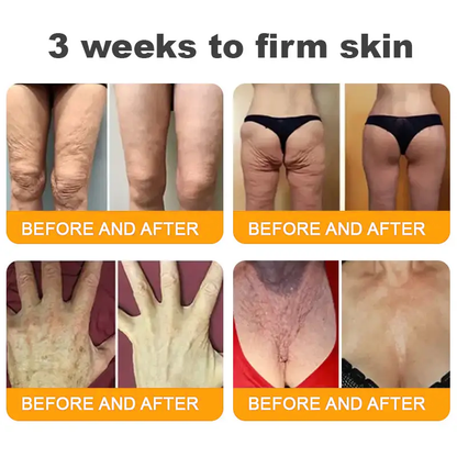 ⏰ LAST DAY 80% OFF ✨ ODEIUN™ Bee Venom Skin Restoration Cream