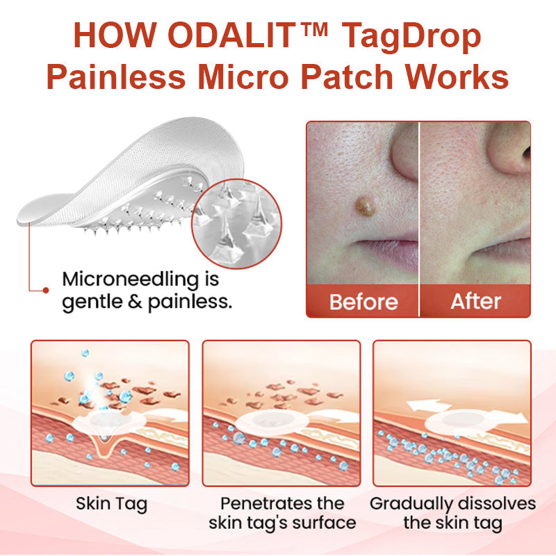 🔥ODALIT™ painless micro-patch🔥