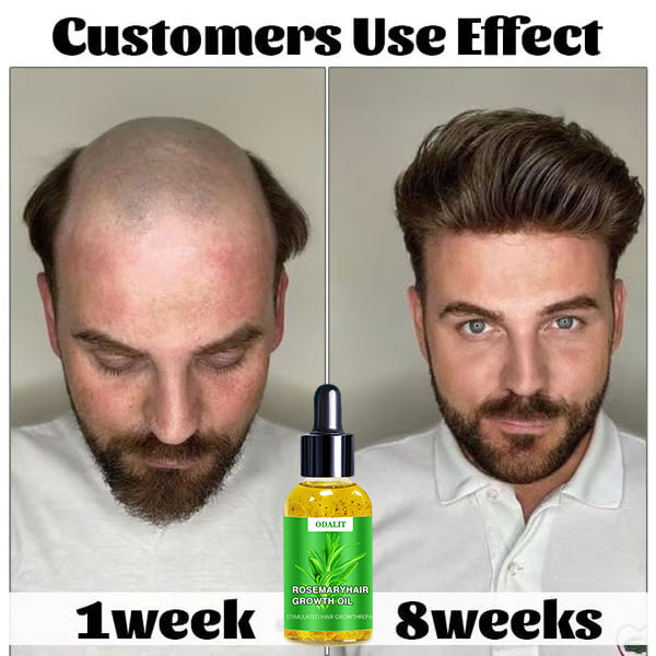 🌱ODALIT™ Hair Growth Serum