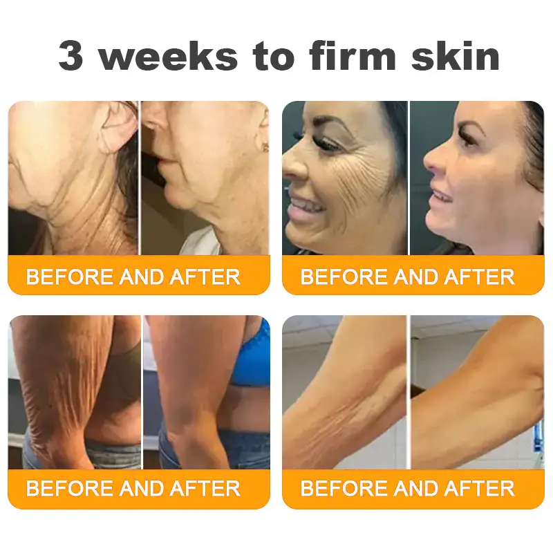 ⏰ LAST DAY 80% OFF ✨ ODEIUN™ Bee Venom Skin Restoration Cream