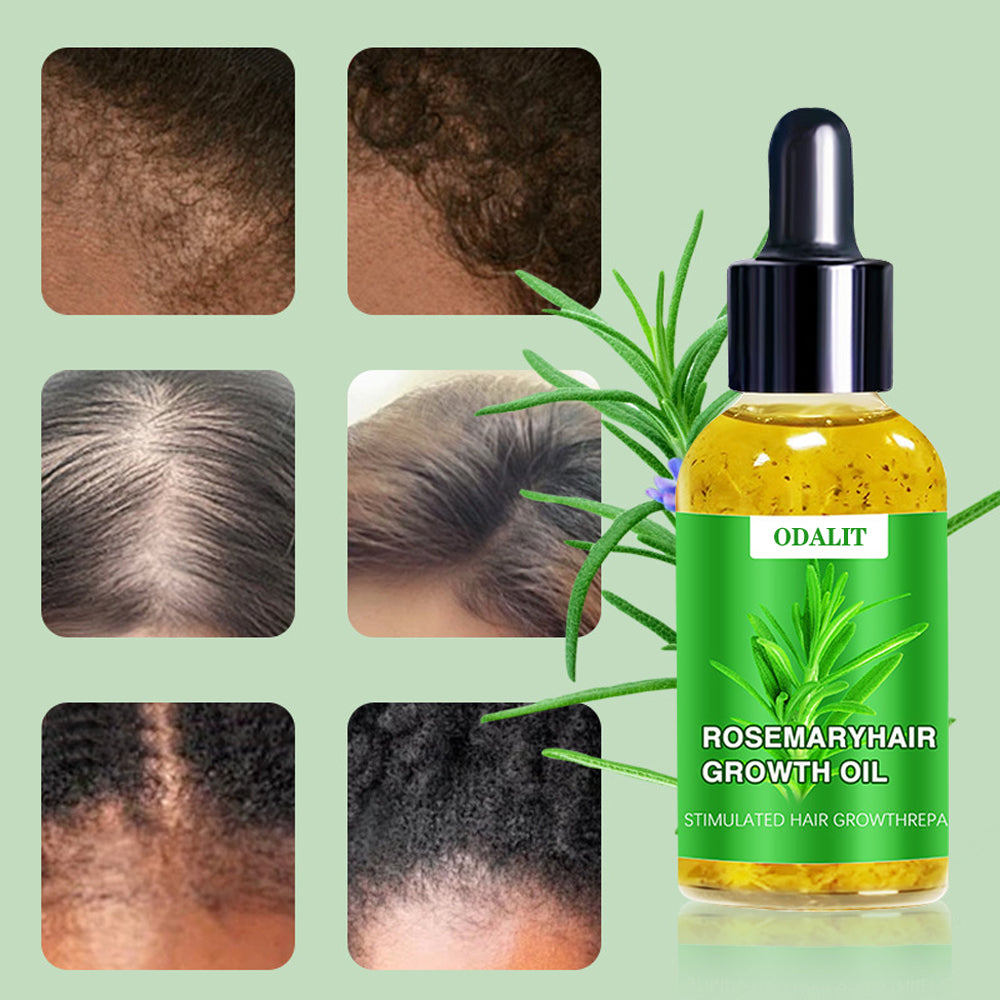 🌱ODALIT™ Hair Growth Serum