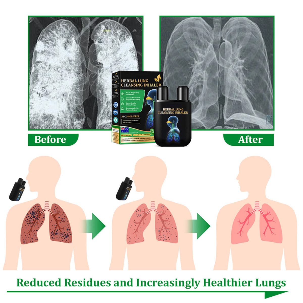 ✅Official Store: Herbal Lung Cleansing Inhaler