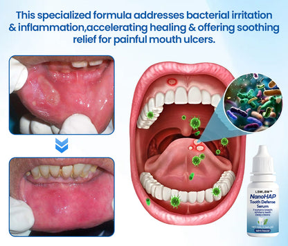 LBMLBM™ NanoHAP Tooth Defense Serum