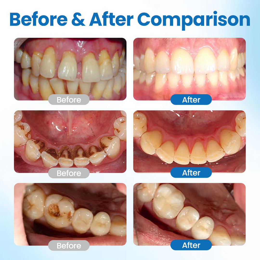 LBMLBM™ NanoHAP Tooth Defense Serum