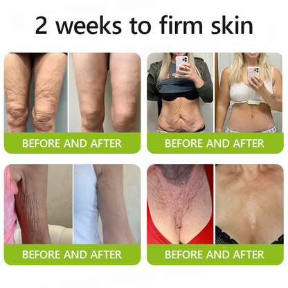 [🥇Last Day 70% OFF] ODALIT™ Botox & Retinol Shot - Eraser for Deep Wrinkles, Sagging Jowls & Puffy Eyes