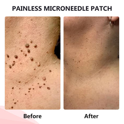 🔥ODALIT™ painless micro-patch🔥