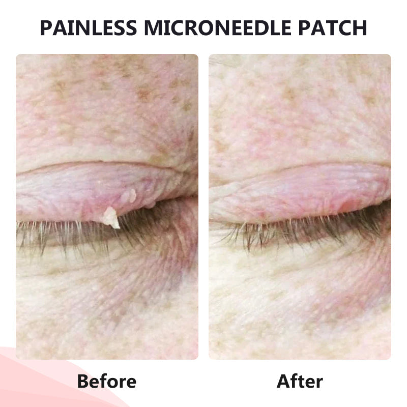 🔥ODALIT™ painless micro-patch🔥