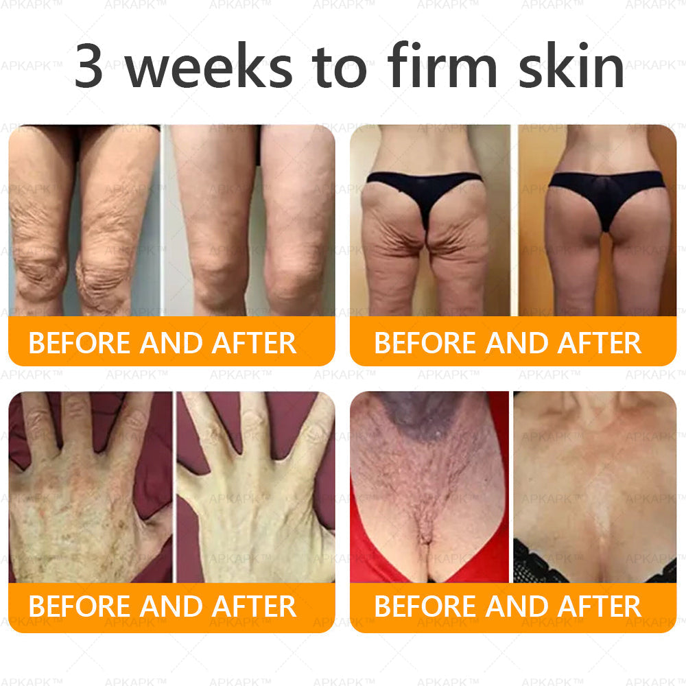 Made and Shipped from AU ✨ LBMLBM® Bee venom Comprehensive Cream 🔥 LAST DAY 80% OFF 💎💎