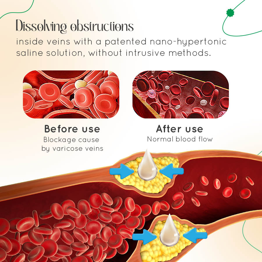 ODALIT™ Vein Therapy Cream🌿