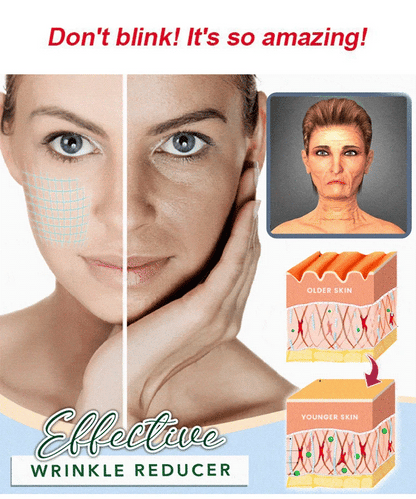 Clinical SkinCare Instant Eye Tightener